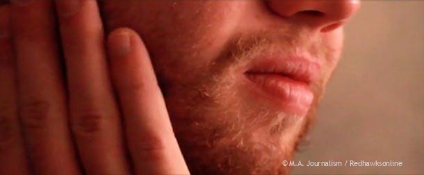 Can Redhawks grow beards?